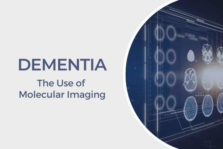 Charazoi Medical Clinic_Dementia_The Use of Molecular Imaging_Dr Andrew Tan